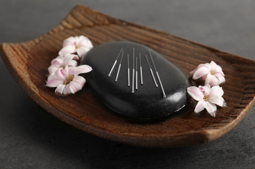 Black spa stone with set of acupuncture needles on tray